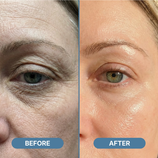 GHK-CU Whipped Tallow Honey Balm with Methylene Blue